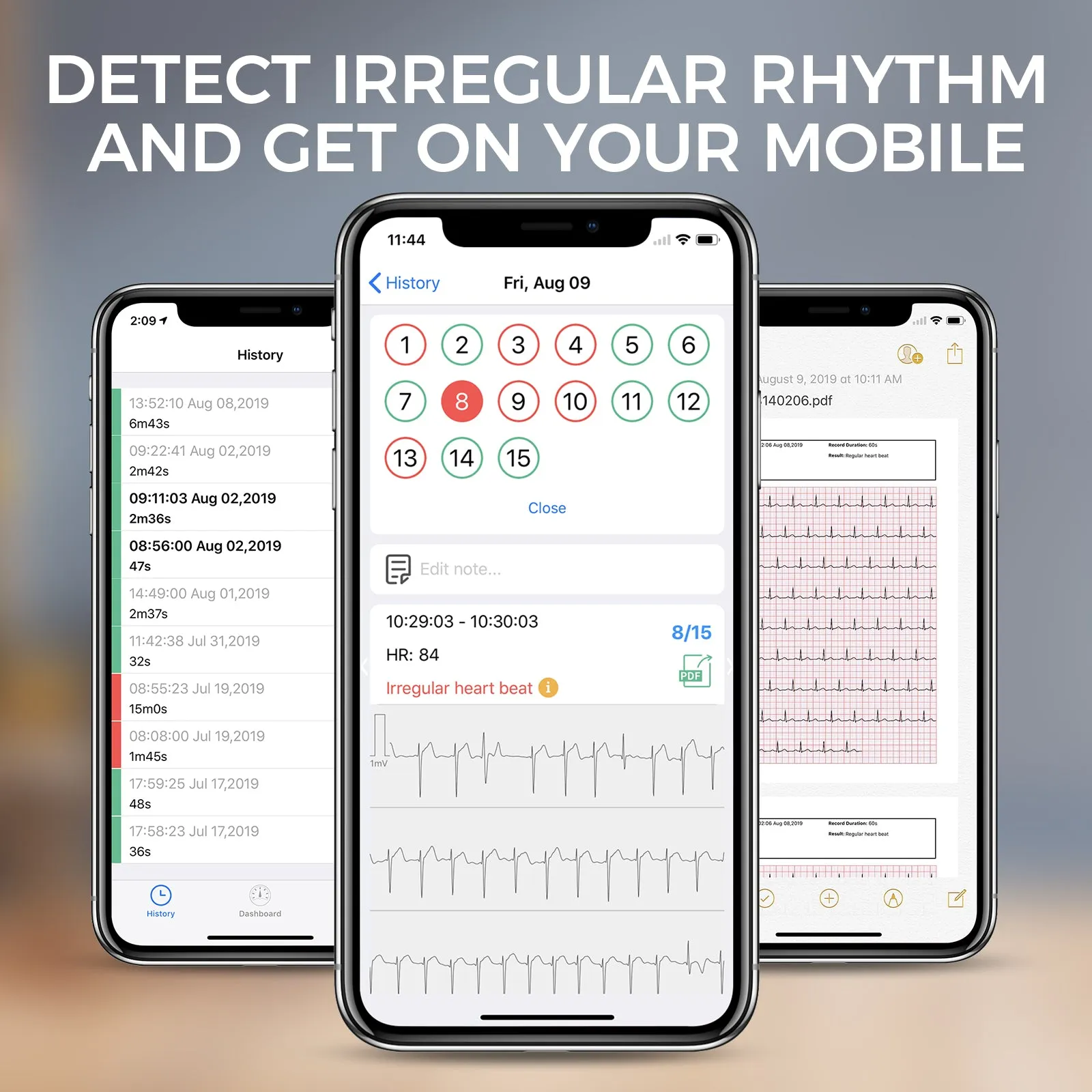 Checkme DuoEK ECG Monitor