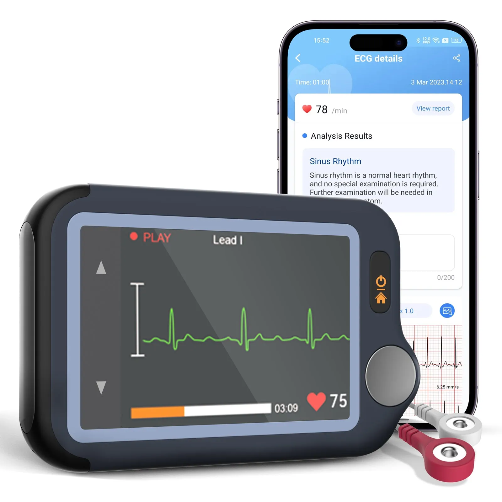 Checkme Pulsebit EX ECG Monitor